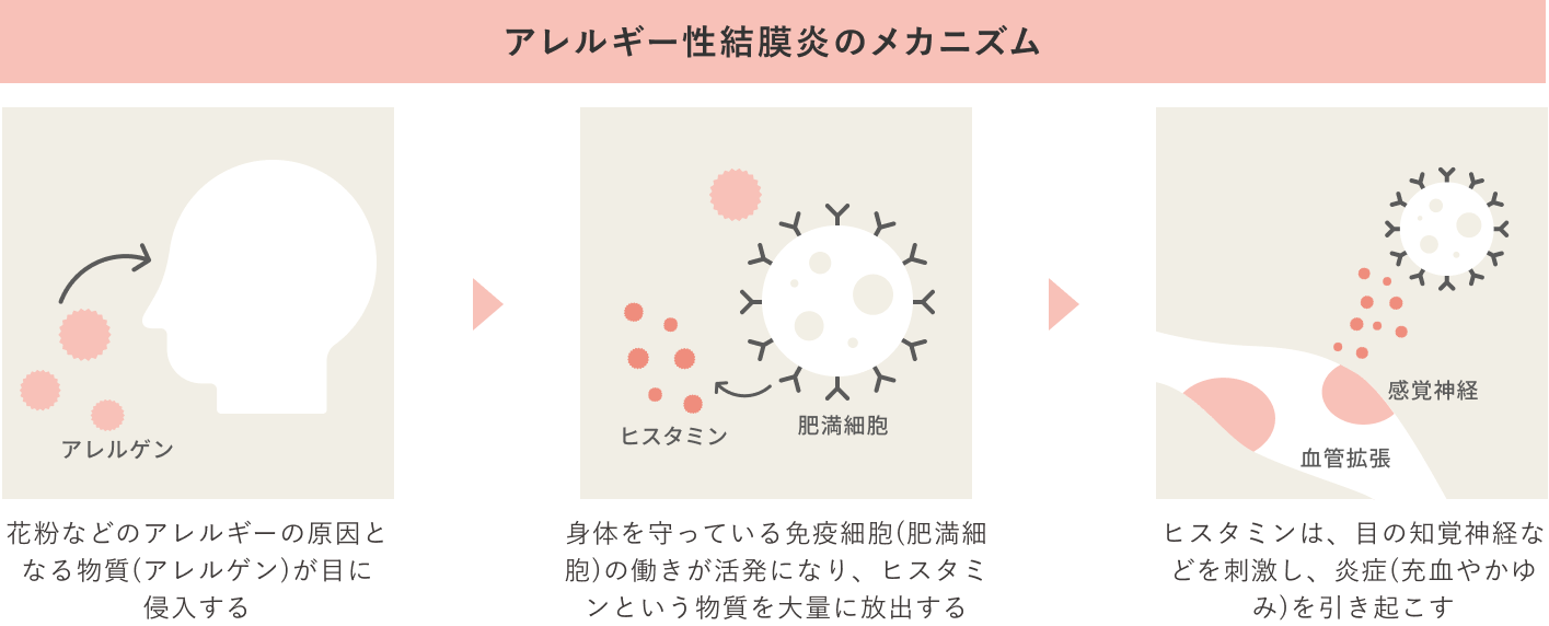 メカニズムの説明...鼻や目などの粘膜に花粉などのアレルゲン（抗原）が付着する → アレルゲンがマスト細胞の抗体部分に結合する → 再度アレルゲンが結合すると、ヒスタミンなどのアレルギー誘発物質が放出される → アレルギー反応により、鼻水、鼻詰まり、くしゃみなどの症状が誘発される