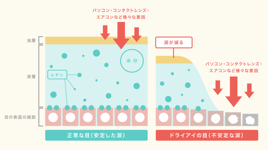 ドライアイのメカニズムの図